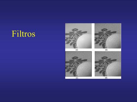 Filtros.