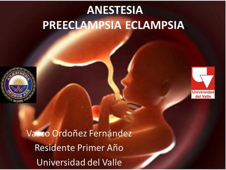 ANESTESIA PREECLAMPSIA ECLAMPSIA.