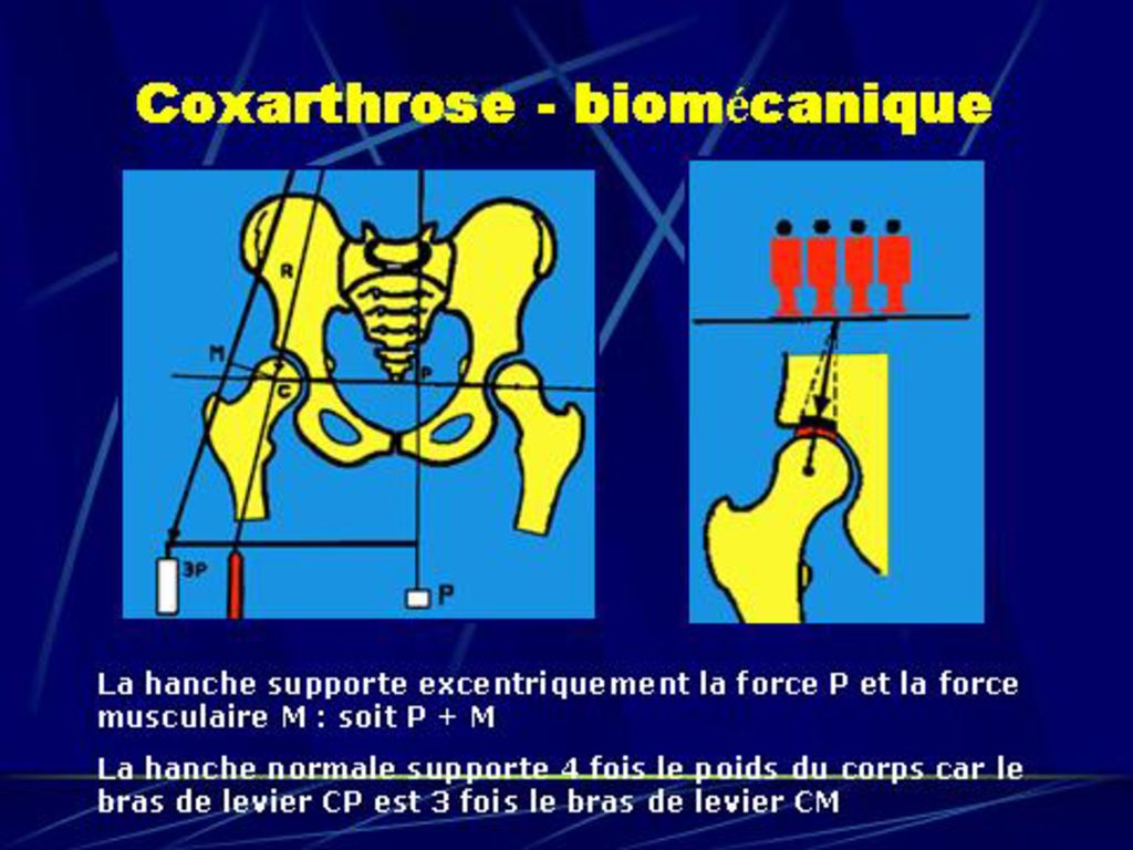 FRACTURILE BAZINULUI. - ppt descargar