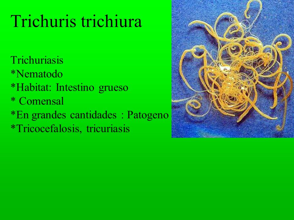 Trichuris trichiura Trichuriasis. Nematodo. Habitat: Intestino grueso - video online descargar
