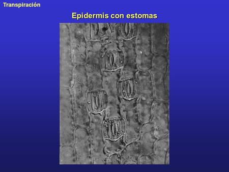 Epidermis con estomas PP0413B.jpg.