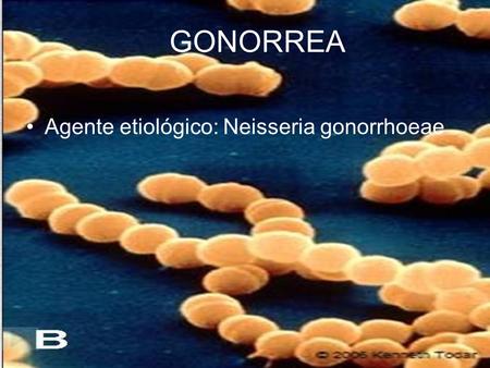 GONORREA Agente etiológico: Neisseria gonorrhoeae.
