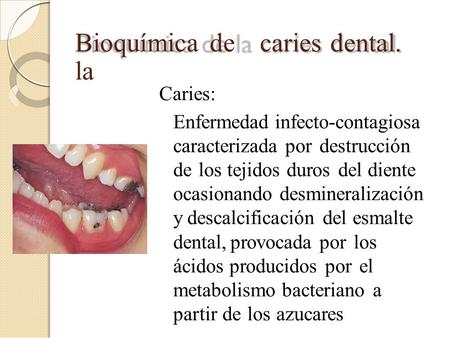 Bioquímica de la caries dental. Caries: