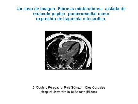 Un caso de Imagen: Fibrosis miotendinosa aislada de músculo papilar posteromedial como expresión de isquemia miocárdica. D. Cordero Pereda, L. Ruiz.