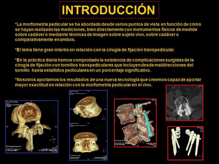 *La morfometría pedicular se ha abordado desde varios puntos de vista en función de cómo se hayan realizado las mediciones, bien directamente con instrumentos.