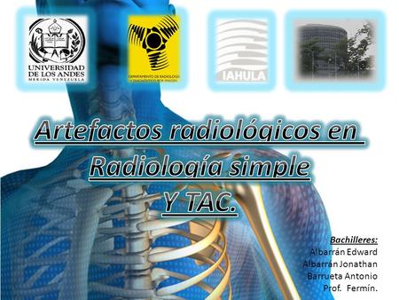 Artefactos radiológicos en