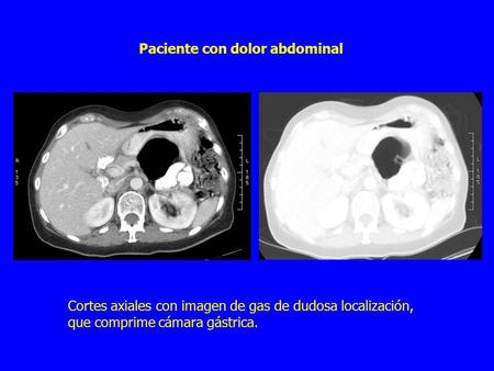 Paciente con dolor abdominal