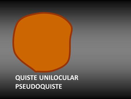 QUISTE UNILOCULAR PSEUDOQUISTE.