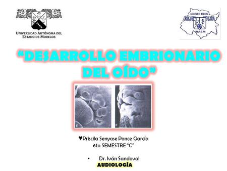 “DESARROLLO EMBRIONARIO DEL OÍDO”