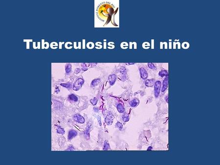 Tuberculosis en el niño