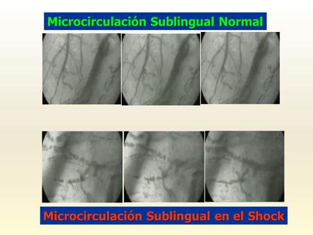 Microcirculación Sublingual Normal