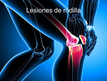 Lesiones de rodilla.