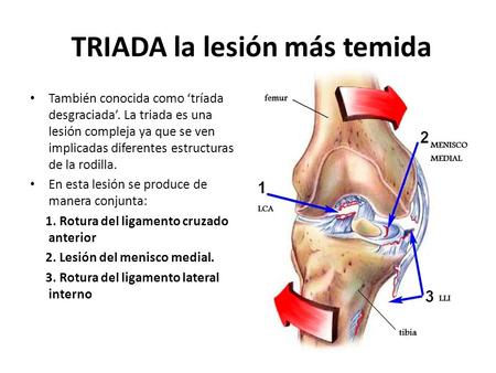 TRIADA la lesión más temida