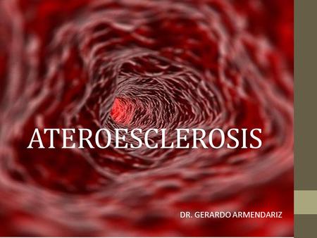 ATEROESCLEROSIS DR. GERARDO ARMENDARIZ.