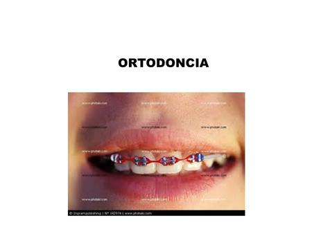ORTODONCIA. Concepto Es la ciencia que estudia, previene, diagnostica y trata las anomalías de forma, posición, relación y función de las estructuras.