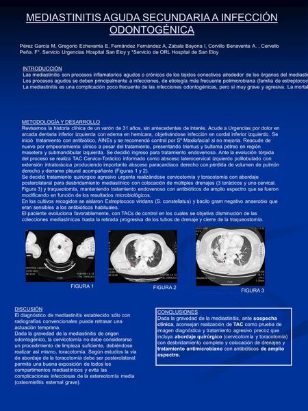 MEDIASTINITIS AGUDA SECUNDARIA A INFECCIÓN ODONTOGÉNICA