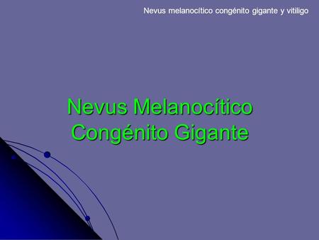 Nevus melanocítico congénito gigante y vitiligo Nevus Melanocítico Congénito Gigante.