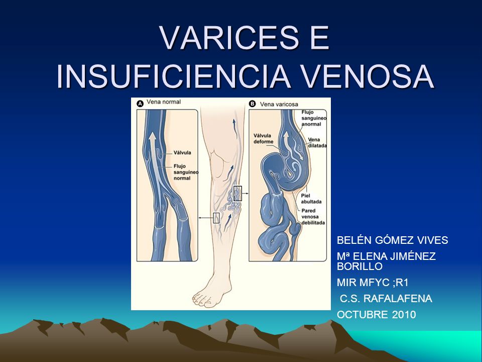 diferena de tromboflebita din varicoza