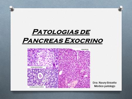 Patologias de Pancreas Exocrino
