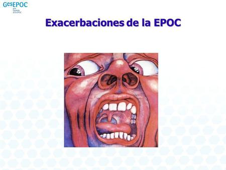 Exacerbaciones de la EPOC
