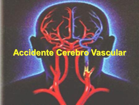 Accidente Cerebro Vascular