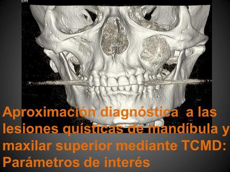 Aproximación diagnóstica a las lesiones quísticas de mandíbula y maxilar superior mediante TCMD: Parámetros de interés.