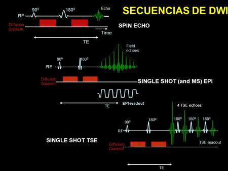 SECUENCIAS DE DWI SPIN ECHO SINGLE SHOT (and MS) EPI SINGLE SHOT TSE