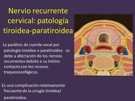 Nervio recurrente cervical: patología tiroidea-paratiroidea La parálisis de cuerda vocal por patología tiroidea o paratiroidea se debe a afectación de.