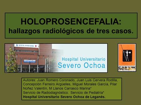 HOLOPROSENCEFALIA: hallazgos radiológicos de tres casos.