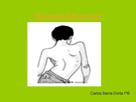 Distrofia Muscular Carlos Sierra Dorta 1ºB.