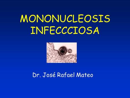 MONONUCLEOSIS INFECCCIOSA