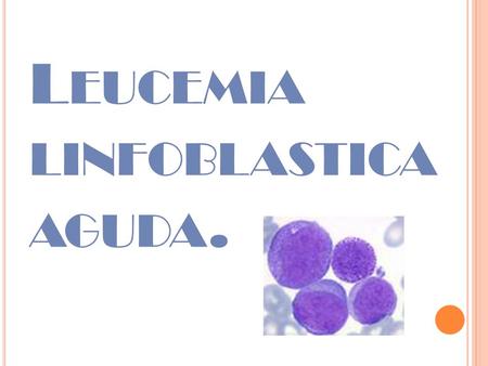 Leucemia linfoblastica aguda.