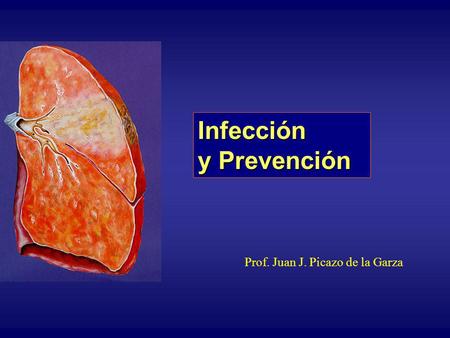 Infección y Prevención Prof. Juan J. Picazo de la Garza.