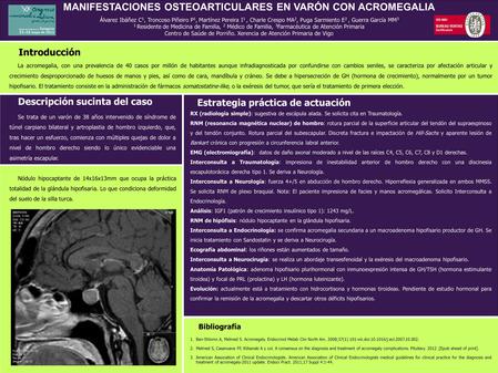 MANIFESTACIONES OSTEOARTICULARES EN VARÓN CON ACROMEGALIA