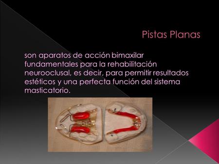 Pistas Planas son aparatos de acción bimaxilar fundamentales para la rehabilitación neurooclusal, es decir, para permitir resultados estéticos y una perfecta.