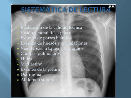 SISTEMÁTICA DE LECTURA