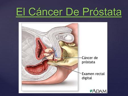 anatomía próstata slideshare)