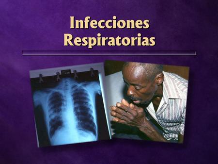 Infecciones Respiratorias. ¿Qué causa estas enfermedades?