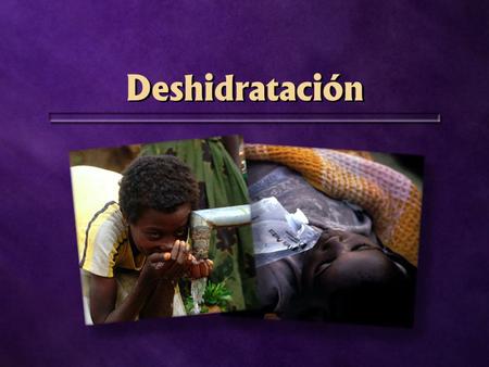 Deshidratación. 70% agua 70% agua ¿Cuál es la causa de la deshidratación? No tomar suficiente agua Sudar bastante Diarrea o vómito Demasiado enfermo.