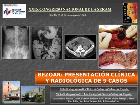 BEZOAR: PRESENTACIÓN CLÍNICA Y RADIOLÓGICA DE 9 CASOS