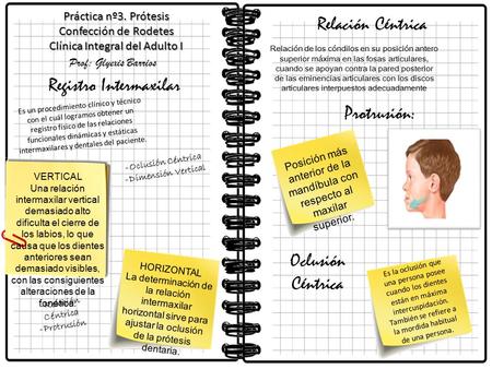 Registro Intermaxilar Protrusión: