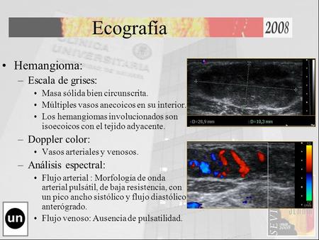 Ecografía Hemangioma: –Escala de grises: Masa sólida bien circunscrita. Múltiples vasos anecoicos en su interior. Los hemangiomas involucionados son isoecoicos.