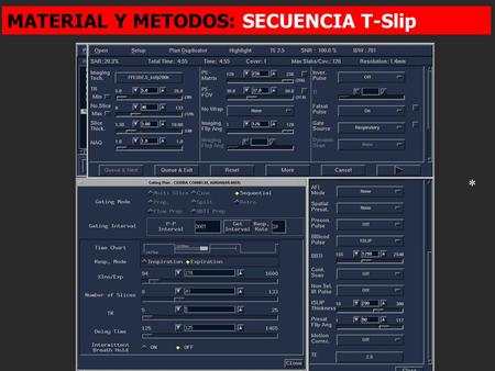* MATERIAL Y METODOS: SECUENCIA T-Slip. Con incremento BBTI Se aplica un pulso selectivo de inversión sobre la zona de interés que genera un efecto de.