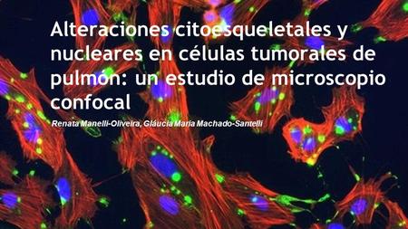 Alteraciones citoesqueletales y nucleares en células tumorales de pulmón: un estudio de microscopio confocal Renata Manelli-Oliveira, Gláucia Maria Machado-Santelli.