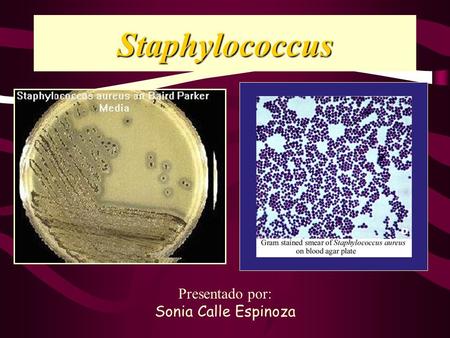Staphylococcus Presentado por: Sonia Calle Espinoza.