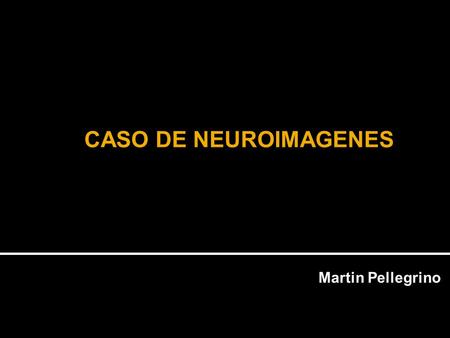 CASO DE NEUROIMAGENES Martin Pellegrino.