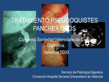 TRATAMIENTO PSEUDOQUISTES PANCREÁTICOS Congreso Sociedad Valenciana de Cirugía Digestiva. Valencia 2009 Servicio de Patología Digestiva Consorcio Hospital.