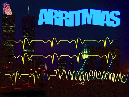 ARRITMIAS.