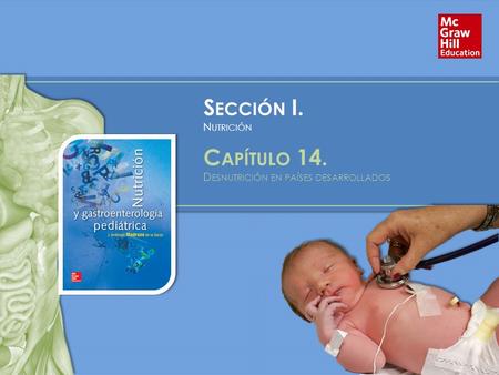 S ECCIÓN I. N UTRICIÓN C APÍTULO 14. D ESNUTRICIÓN EN PAÍSES DESARROLLADOS.