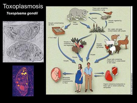 Toxoplasmosis Toxoplasma gondii.